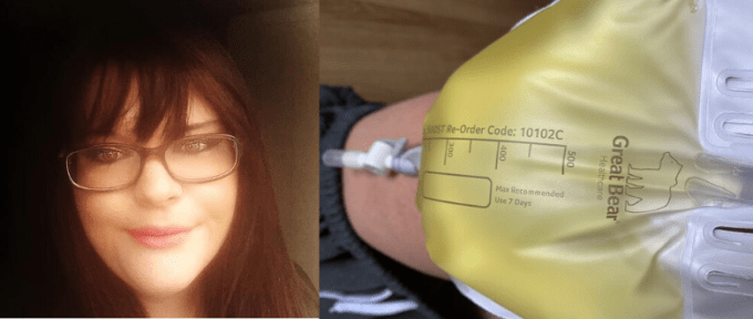 photo of jade and catheter