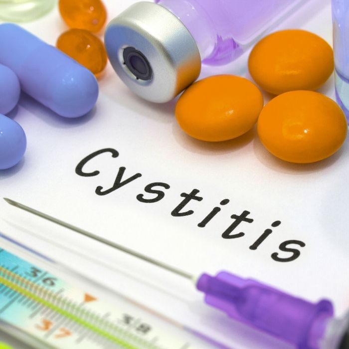 cystitis graphic