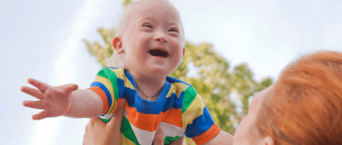 Down Syndrome child